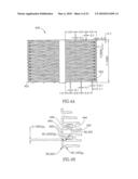 FLOW REDUCING IMPLANT diagram and image