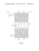 FLOW REDUCING IMPLANT diagram and image