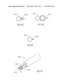 FLOW REDUCING IMPLANT diagram and image