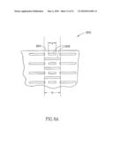 FLOW REDUCING IMPLANT diagram and image