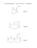 FLOW REDUCING IMPLANT diagram and image