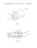 FLOW REDUCING IMPLANT diagram and image