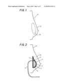 Breast Prosthesis and Breast Augmentation Using the Breast Prosthesis diagram and image