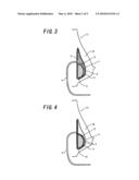 Breast Prosthesis and Breast Augmentation Using the Breast Prosthesis diagram and image