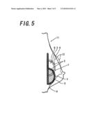 Breast Prosthesis and Breast Augmentation Using the Breast Prosthesis diagram and image