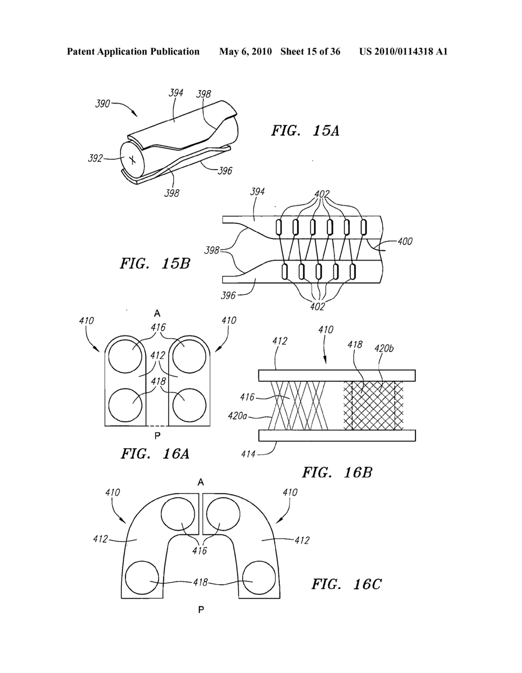 Prosthetic Intervertebral Discs - diagram, schematic, and image 16