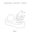 Method for manipulating a dental virtual model, method for creating physical entities based on a dental virtual model thus manipulated, and dental models thus created diagram and image