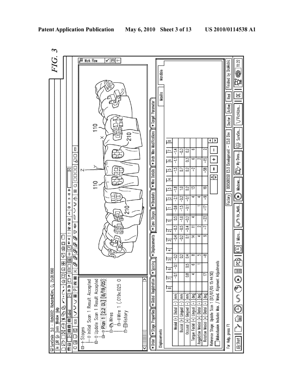 METHOD AND APPARATUS FOR DIGITALLY EVALUATING INSERTION QUALITY OF CUSTOMIZED ORTHODONTIC ARCH WIRE - diagram, schematic, and image 04
