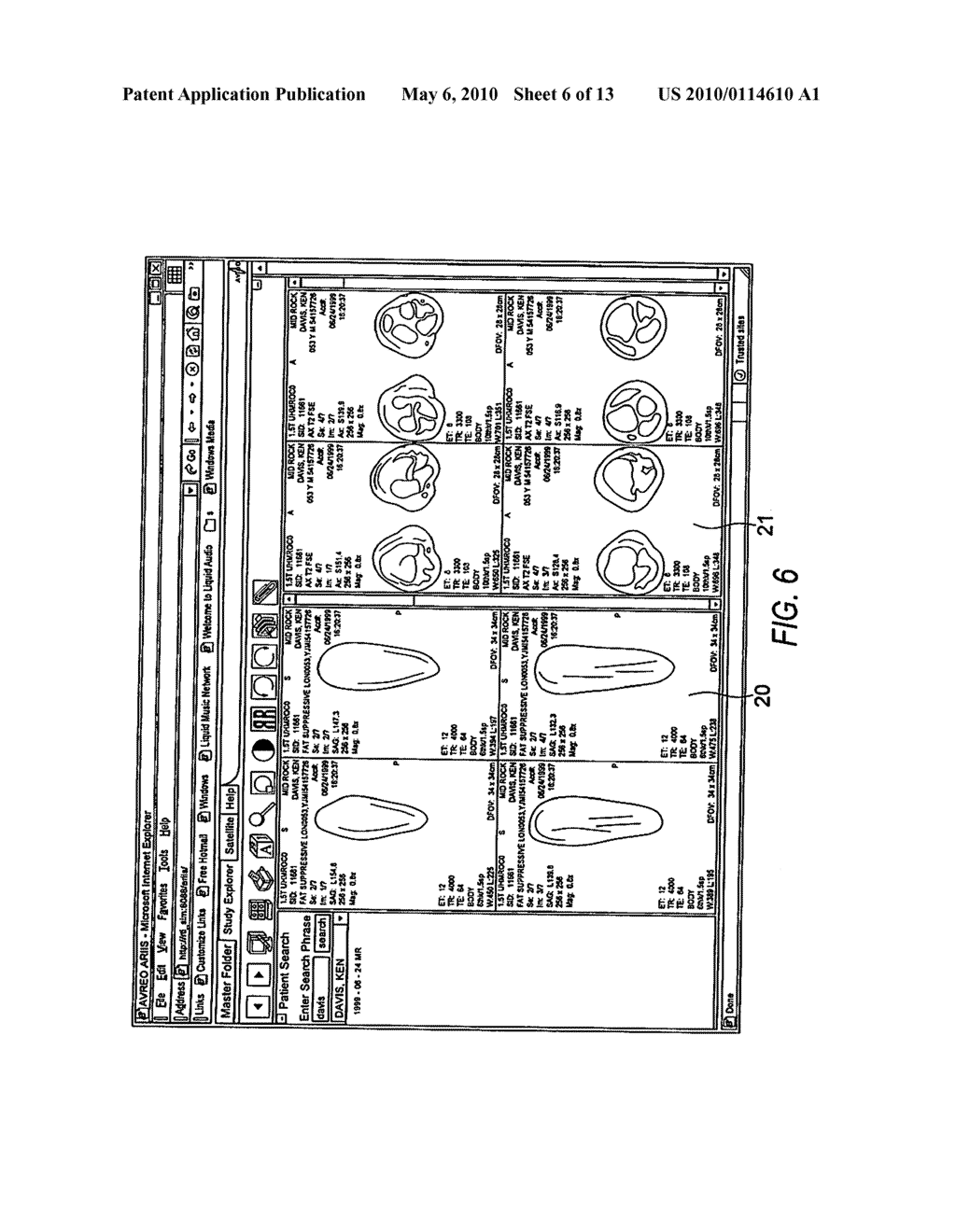 Electronic Method and System That Improves Efficiencies for Rendering Diagnosis of Radiology Procedures - diagram, schematic, and image 07