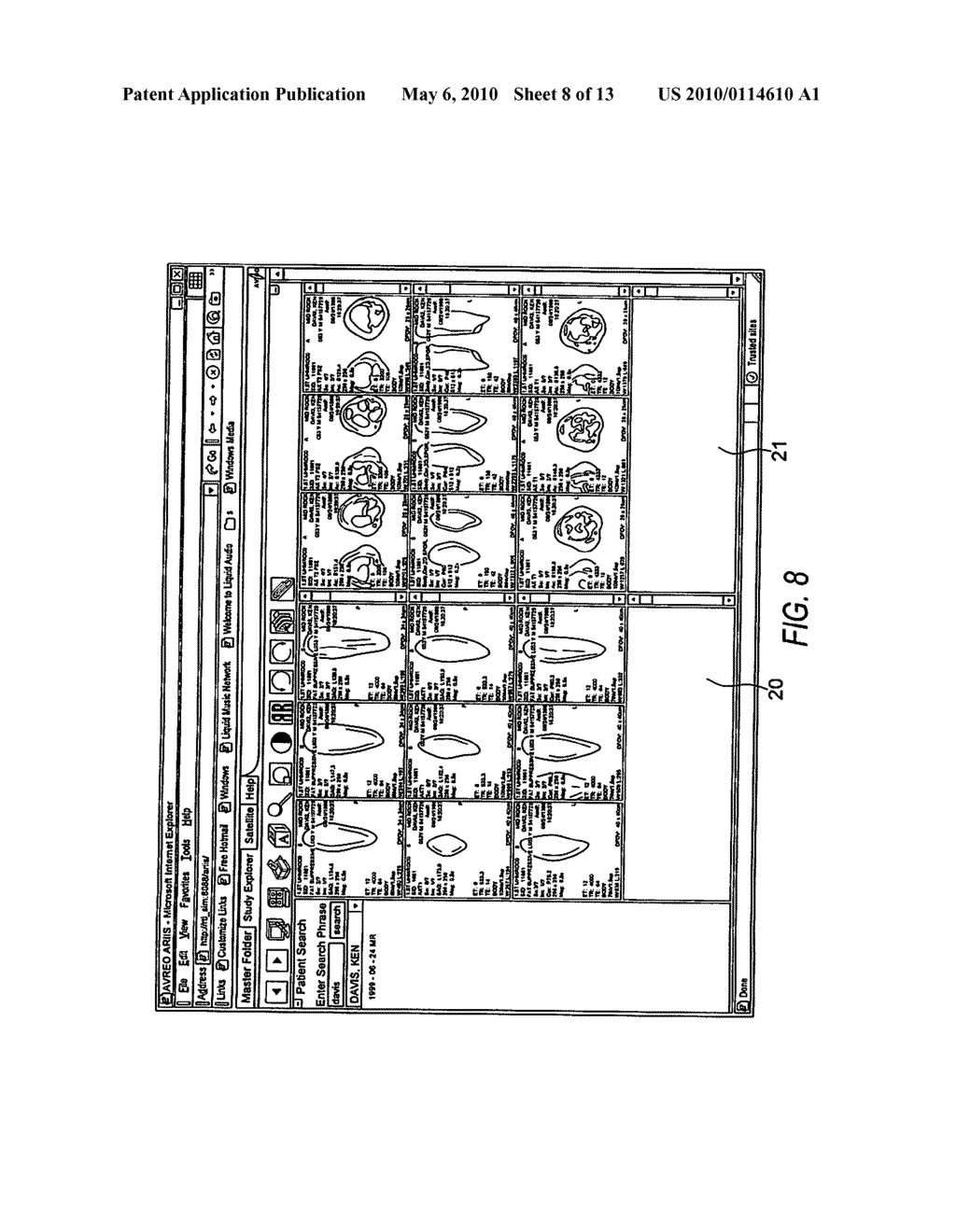 Electronic Method and System That Improves Efficiencies for Rendering Diagnosis of Radiology Procedures - diagram, schematic, and image 09