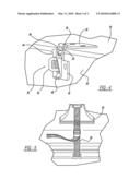 HOCKEY STICKS TRANSPORT CARRIER FOR A VEHICLE diagram and image