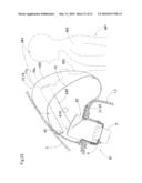 AIRBAG APPARATUS FOR A FRONT PASSENGER S SEAT diagram and image