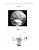 Method Of Forming Virtual Endoscope Image Of Uterus diagram and image