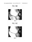 Method Of Forming Virtual Endoscope Image Of Uterus diagram and image