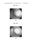 Method Of Forming Virtual Endoscope Image Of Uterus diagram and image