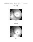 Method Of Forming Virtual Endoscope Image Of Uterus diagram and image
