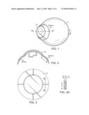 Scleral Contact Lens with Grooves and Method of Making Lens diagram and image