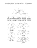 Scleral Contact Lens with Grooves and Method of Making Lens diagram and image