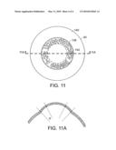 Scleral Contact Lens with Grooves and Method of Making Lens diagram and image