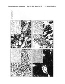 PLEXIN D1 AS A TARGET FOR TUMOR DIAGNOSIS AND THERAPY diagram and image