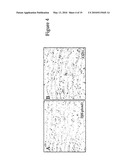 PLEXIN D1 AS A TARGET FOR TUMOR DIAGNOSIS AND THERAPY diagram and image