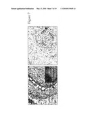 PLEXIN D1 AS A TARGET FOR TUMOR DIAGNOSIS AND THERAPY diagram and image