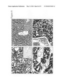 PLEXIN D1 AS A TARGET FOR TUMOR DIAGNOSIS AND THERAPY diagram and image