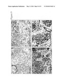 PLEXIN D1 AS A TARGET FOR TUMOR DIAGNOSIS AND THERAPY diagram and image