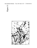 PLEXIN D1 AS A TARGET FOR TUMOR DIAGNOSIS AND THERAPY diagram and image