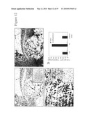 PLEXIN D1 AS A TARGET FOR TUMOR DIAGNOSIS AND THERAPY diagram and image