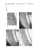 PLEXIN D1 AS A TARGET FOR TUMOR DIAGNOSIS AND THERAPY diagram and image