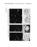 PLEXIN D1 AS A TARGET FOR TUMOR DIAGNOSIS AND THERAPY diagram and image