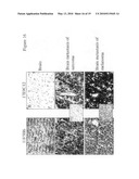 PLEXIN D1 AS A TARGET FOR TUMOR DIAGNOSIS AND THERAPY diagram and image