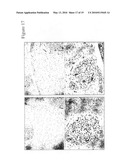 PLEXIN D1 AS A TARGET FOR TUMOR DIAGNOSIS AND THERAPY diagram and image