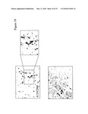 PLEXIN D1 AS A TARGET FOR TUMOR DIAGNOSIS AND THERAPY diagram and image