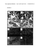 Antibodies Against Cancer diagram and image