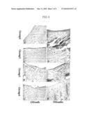 THERAPEUTIC COMPOSITE FOR CARTILAGE DISORDER USING EXTRACELLULAR MATRIX (ECM) SCAFFOLD diagram and image