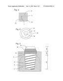 ARTIFICIAL DENTAL PROTHESIS, METHOD FOR THE PRODUCTION OF AN ANCHORING PART diagram and image