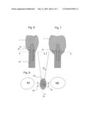 ARTIFICIAL DENTAL PROTHESIS, METHOD FOR THE PRODUCTION OF AN ANCHORING PART diagram and image