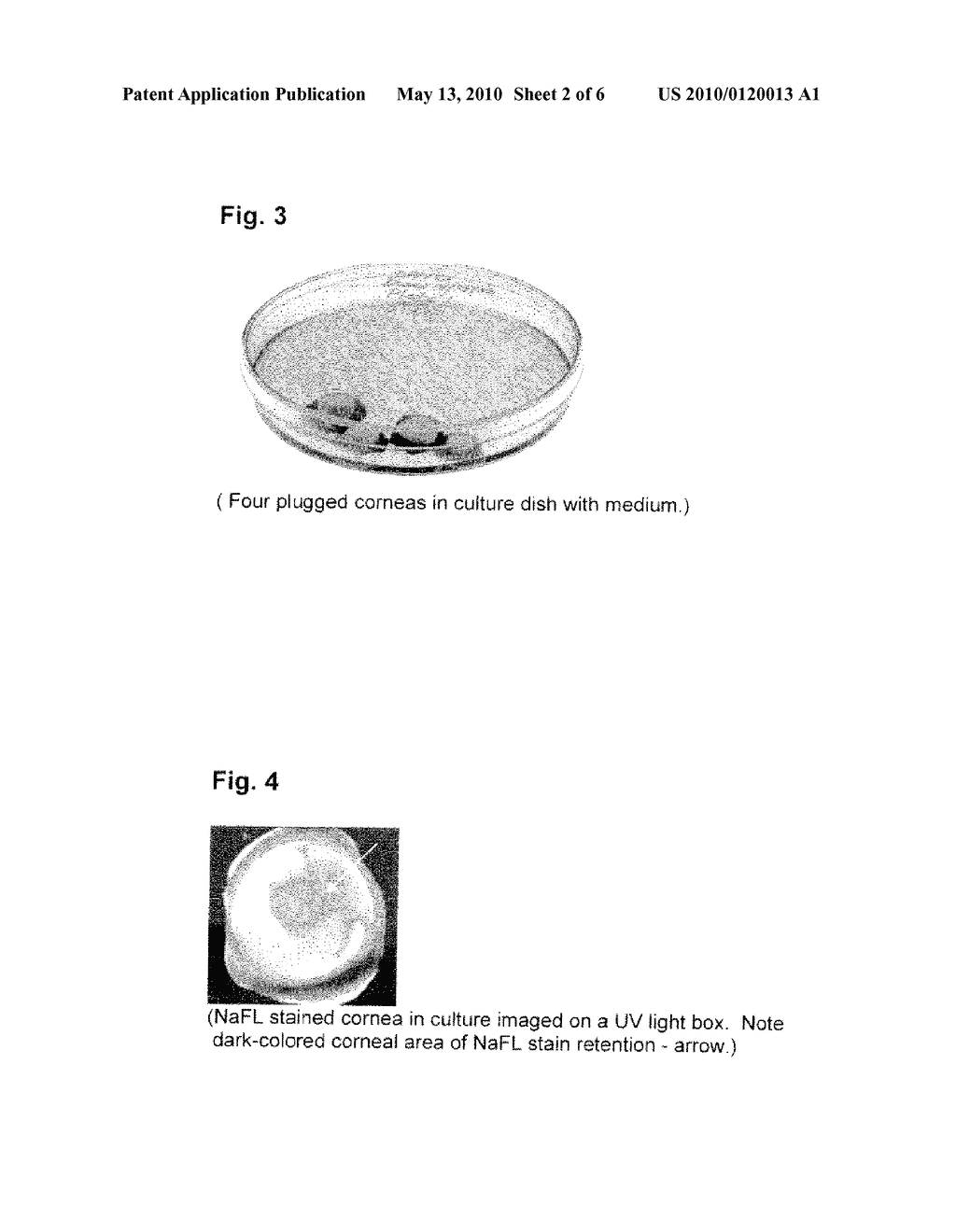 PROCEDURE FOR LONG TERM CORNEAL CULTURE - diagram, schematic, and image 03