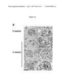 METHODS FOR DETECTING AND TREATING KIDNEY DISEASE diagram and image