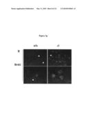 METHODS FOR DETECTING AND TREATING KIDNEY DISEASE diagram and image