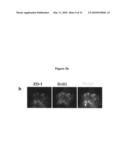 METHODS FOR DETECTING AND TREATING KIDNEY DISEASE diagram and image