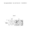 METHODS FOR DETECTING AND TREATING KIDNEY DISEASE diagram and image