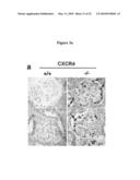 METHODS FOR DETECTING AND TREATING KIDNEY DISEASE diagram and image