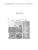 METHODS FOR DETECTING AND TREATING KIDNEY DISEASE diagram and image