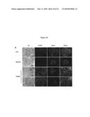 METHODS FOR DETECTING AND TREATING KIDNEY DISEASE diagram and image