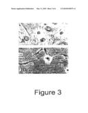 Trans-Differentiation And Re-Differentiation Of Somatic Cells And Production Of Cells For Cell Therapies diagram and image