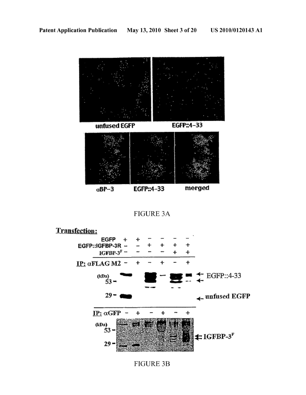 INDUCTION OF APOPTOSIS AND CELL GROWTH INHIBITION BY PROTEIN 4.33 - diagram, schematic, and image 04