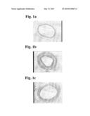 Compositions for Treating Hyperproliferative Vascular Disorders and Cancers diagram and image